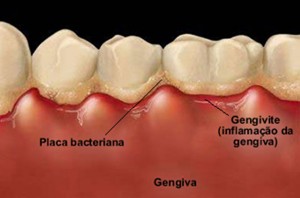 periodontologia1