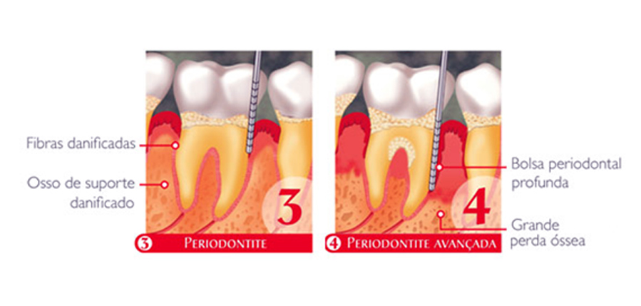 periodontologia3